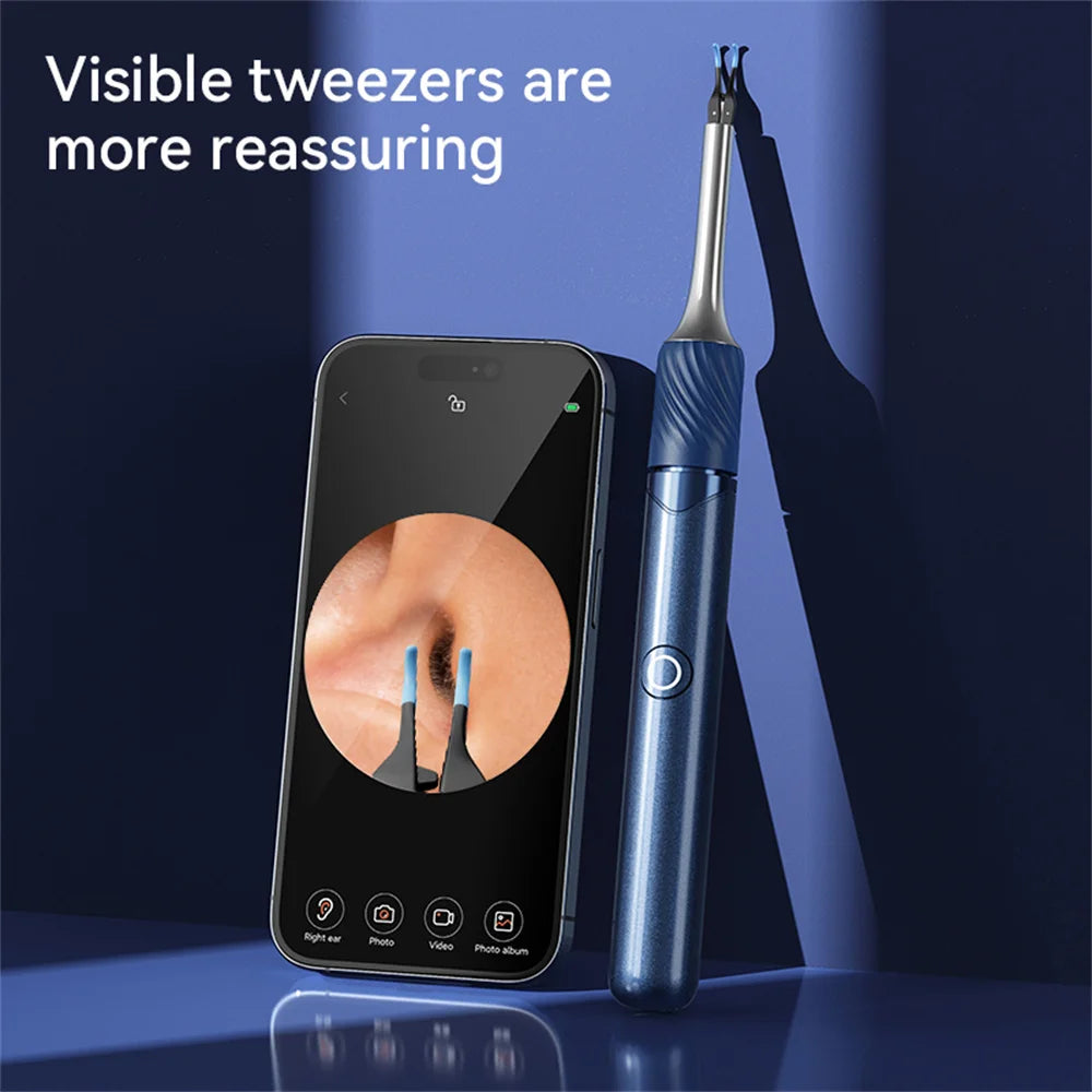 Ear Wax Removal Tool with Camera – 12MP Visual Ear Cleaner + Tweezers & Ear Picks